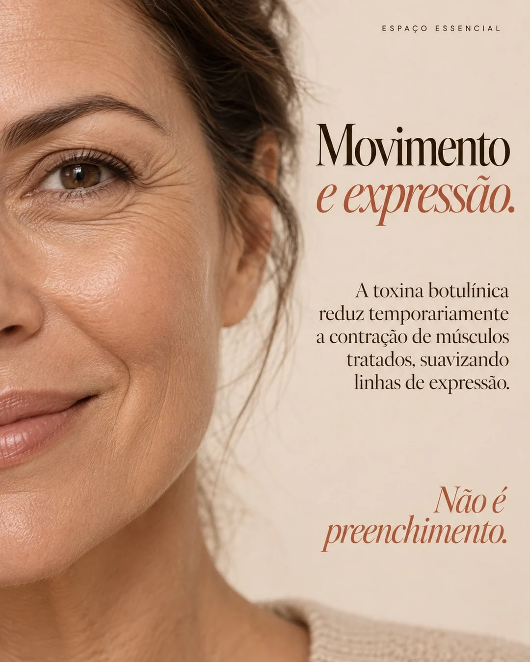 Planejamento do botox, arte 2 de 5